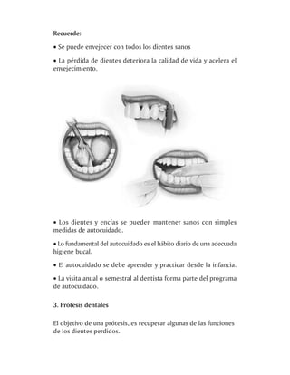 Recuerde:

· Se puede envejecer con todos los dientes sanos
· La pérdida de dientes deteriora la calidad de vida y acelera el
envejecimiento.




· Los dientes y encías se pueden mantener sanos con simples
medidas de autocuidado.
· Lo fundamental del autocuidado es el hábito diario de una adecuada
higiene bucal.
· El autocuidado se debe aprender y practicar desde la infancia.
· La visita anual o semestral al dentista forma parte del programa
de autocuidado.

3. Prótesis dentales

El objetivo de una prótesis, es recuperar algunas de las funciones
de los dientes perdidos.
 