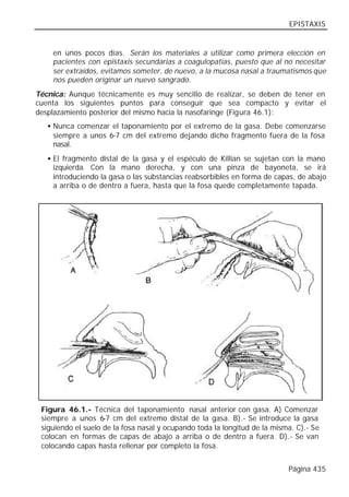 EPISTAXIS


    en unos pocos días. Serán los materiales a utilizar como primera elección en
    pacientes con epistaxis secundarias a coagulopatías, puesto que al no necesitar
    ser extraídos, evitamos someter, de nuevo, a la mucosa nasal a traumatismos que
    nos pueden originar un nuevo sangrado.
Técnica: Aunque técnicamente es muy sencillo de realizar, se deben de tener en
cuenta los siguientes puntos para conseguir que sea compacto y evitar el
desplazamiento posterior del mismo hacia la nasofaringe (Figura 46.1):
   • Nunca comenzar el taponamiento por el extremo de la gasa. Debe comenzarse
     siempre a unos 6-7 cm del extremo dejando dicho fragmento fuera de la fosa
     nasal.
   • El fragmento distal de la gasa y el espéculo de Killian se sujetan con la mano
     izquierda. Con la mano derecha, y con una pinza de bayoneta, se irá
     introduciendo la gasa o las substancias reabsorbibles en forma de capas, de abajo
     a arriba o de dentro a fuera, hasta que la fosa quede completamente tapada.




 Figura 46.1.- Técnica del taponamiento nasal anterior con gasa. A) Comenzar
 siempre a unos 6-7 cm del extremo distal de la gasa. B).- Se introduce la gasa
 siguiendo el suelo de la fosa nasal y ocupando toda la longitud de la misma. C).- Se
 colocan en formas de capas de abajo a arriba o de dentro a fuera. D).- Se van
 colocando capas hasta rellenar por completo la fosa.


                                                                           Página 435
 