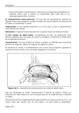 EPISTAXIS


   • Una vez finalizado el taponamiento, colocaremos un fragmento de algodón en el
     vestíbulo nasal y por el exterior un esparadrapo para evitar que en un
     estornudo pueda salirse el mismo.
b) Taponamiento nasal posterior.- En este tipo de taponamiento, además de
taponar la fosa nasal sangrante, también se oblitera la coana mediante la colocación de
un tapón en nasofaringe o cavum.
Indicaciones: En las epistaxis posteriores y en los casos en que el taponamiento
nasal anterior sea ineficaz.
Materiales: El taponamiento nasal posterior se puede colocar de distintas formas:
1) Con sondas de doble balón.- Si disponemos de ellas, las utilizaremos como
primera medida ya que son fáciles de colocar y consiguen el control de la mayor parte
de las epistaxis posteriores.
Técnicamente, son muy sencillas de colocar y pueden ser utilizadas por el personal
del Área de Urgencias. Deben de seguirse los siguientes pasos:
Se lubrificará la sonda y la introduciremos por la fosa nasal sangrante siguiendo el
suelo de la misma (como si de una sonda nasogástrica se tratase).




   Figura 46.2.- Taponamiento nasal posterior con sonda de doble balón.

Una vez introducida la sonda, comenzaremos a hinchar los balones. Deben de
rellenarse con suero salino y no con aire puesto que así, la compresión que se obtiene
es mayor.
Hincharemos primero el balón posterior (generalmente se requieren entre 6 y 9 cc. de
suero) hasta que veamos que no cae sangre a la boca desde la nasofaringe.

Página 436
 