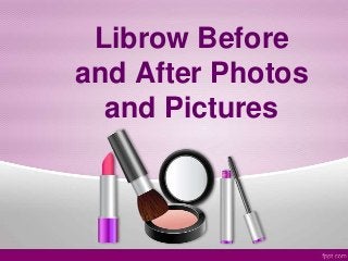 Librow Before
and After Photos
and Pictures
 