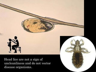 Head lice are not a sign of
uncleanliness and do not vector
disease organisms.
 