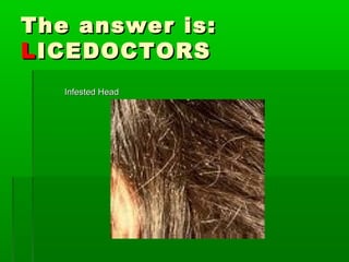 The answer is:The answer is:
LLICEDOCTORSICEDOCTORS
Infested HeadInfested Head
 