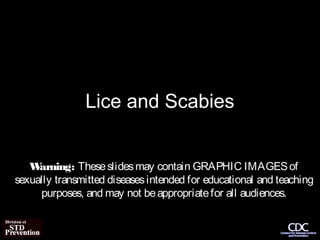 Lice and Scabies


   W arning: These slides may contain GRAPHIC IMAGES of
sexually transmitted diseases intended for educational and teaching
     purposes, and may not be appropriate for all audiences.
 