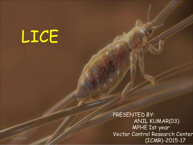 Lice