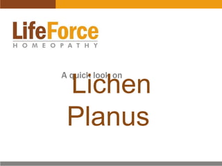 Lichen Planus

 