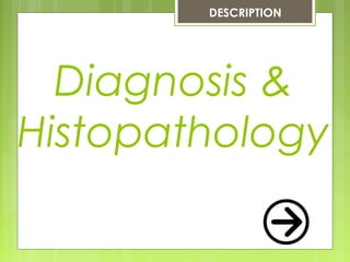 Diagnosis &
Histopathology
DESCRIPTION
 