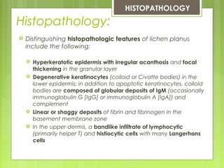 Histopathology:
 Distinguishing histopathologic features of lichen planus
include the following:
 Hyperkeratotic epidermis with irregular acanthosis and focal
thickening in the granular layer
 Degenerative keratinocytes (colloid or Civatte bodies) in the
lower epidermis; in addition to apoptotic keratinocytes, colloid
bodies are composed of globular deposits of IgM (occasionally
immunoglobulin G [IgG] or immunoglobulin A [IgA]) and
complement
 Linear or shaggy deposits of fibrin and fibrinogen in the
basement membrane zone
 In the upper dermis, a bandlike infiltrate of lymphocytic
(primarily helper T) and histiocytic cells with many Langerhans
cells
 HISTOPATHOLOGY
 