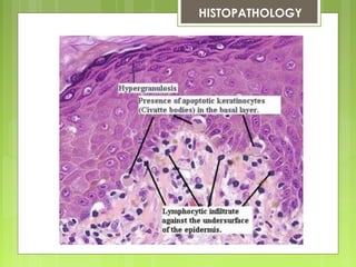  HISTOPATHOLOGY
 