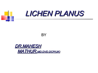 LICHEN PLANUSLICHEN PLANUS
BY
DR.MAHESHDR.MAHESH
MATHURMATHUR,,MD,DVD,DCP(UK)MD,DVD,DCP(UK)
 