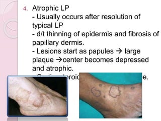 Lichen planus by Dr. Kriti Maheshwari | PPTX