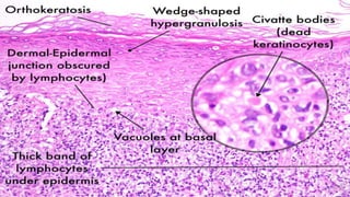 Histopathological changes
 