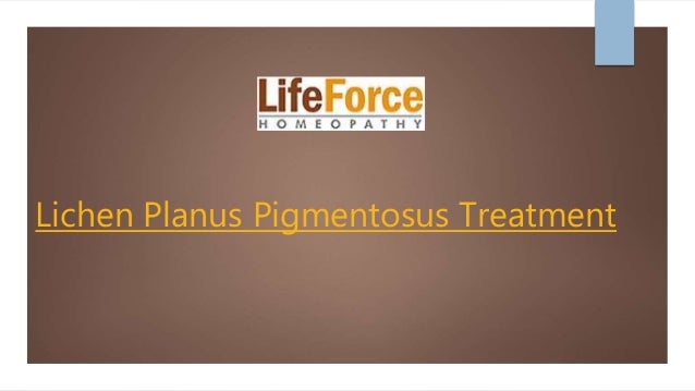 Lichen Planus Pigmentosus Treatment Lichen Planus Pigmentosus Treatment