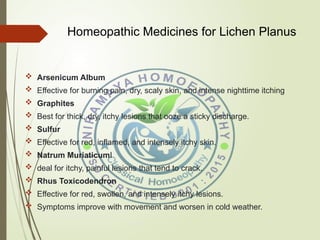 Lichen Planus:Causes , Symptoms and Homeopathic Treatment | PPT