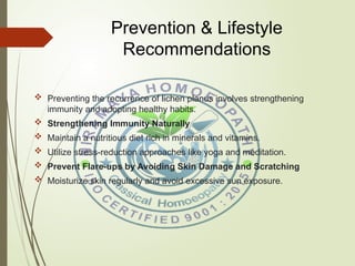 Lichen Planus:Causes , Symptoms and Homeopathic Treatment | PPT