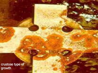 crustose type of
growth
 