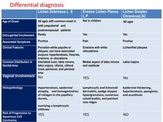 Differential diagnosis
Lichen Sclerosus L S Erosive Lichen Planus
L P
Lichen Simplex
ChronicusLSC
Age of Onset All ages with common onset in
both prepubertal and
postmenopausal patients
Not in children All ages
Extra-genital Involvement Rarely Yes Yes
Associated Symptoms Pruritus Pain Pruritus
Clinical Features Porcelain-white papules or
plaques; can have associated
purpura, hyperkeratosis, fissures,
erosions, or ulcerations
Erosions with white
reticulations
Lichenified plaques
Common Distribution in
Genital Area
Interlabial sulci, labia minora,
labia majora, clitoris, clitoral
hood, perineum, and perianal
area
Medial aspect of labia minora
and vestibule
Labia majora
Vaginal Involvement No YES No
Histopathology Hyperkeratosis, epidermal
atrophy, and homogenization
of collagen in the papillary
dermis,
overlying a lymphocytic
infiltrate.
Lymphocytic and lichenoid
dermatitis, wedge shaped
hypergranulosis, numerous
cytoid bodies, and pointed
rete ridges
Epidermal thickening,
hyperkeratosis, spongiosis,
and acanthosis
Risk of Progression to
Squamous Cell
Carcinoma
YES YES NO
 