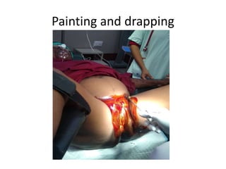 Painting and drapping
 