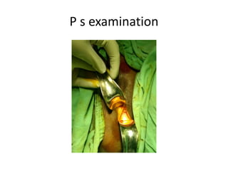 P s examination
 