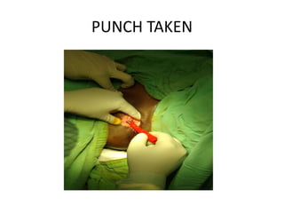 PUNCH TAKEN
 