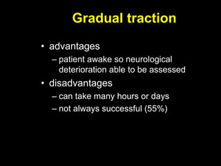 Gradual traction
• advantages
– patient awake so neurological
deterioration able to be assessed
• disadvantages
– can take many hours or days
– not always successful (55%)
 