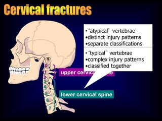0
1
2
3
4
5
6
7
upper cervical spine
lower cervical spine
•‘atypical’ vertebrae
•distinct injury patterns
•separate classifications
•‘typical’ vertebrae
•complex injury patterns
•classified together
 