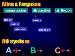 compression distraction lat. flexion
flexion
extension
flexion
vertical
extension
A CB
 