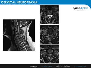Guidelines for return to sport after cervical trauma | PDF