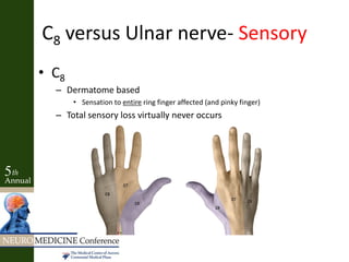 C8 versus Ulnar nerve- Sensory
• C8
– Dermatome based
• Sensation to entire ring finger affected (and pinky finger)
– Total sensory loss virtually never occurs
 