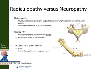 Radiculopathy versus Neuropathy
• Radiculopathy
– Usually involves one spinal nerve root distribution following “myotomal” and “dermatomal”
patterns
– Pathology often proximal (disc or osteophyte)
• Neuropathy
– Usually involves one peripheral nerve branch
– Pathology often entrapment distally
• “Double Crush” phenomenon
– Rare
– Both radiculopathy and neuropathy present
 
