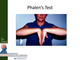 Phalen’s Test
 