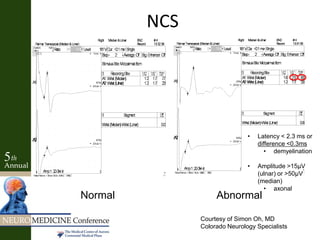 Courtesy of Simon Oh, MD
Colorado Neurology Specialists
Normal Abnormal
• Latency < 2.3 ms or
difference <0.3ms
• demyelination
• Amplitude >15μV
(ulnar) or >50μV
(median)
• axonal
NCS
 