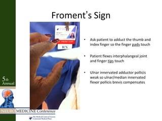 Froment’s Sign
• Ask patient to adduct the thumb and
index finger so the finger pads touch
• Patient flexes interphalangeal joint
and finger tips touch
• Ulnar innervated adductor pollicis
weak so ulnar/median innervated
flexor pollicis brevis compensates
 