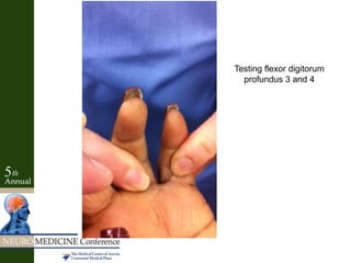 Testing flexor digitorum
profundus 3 and 4
 