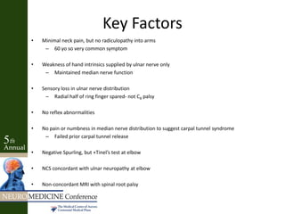 Key Factors
• Minimal neck pain, but no radiculopathy into arms
– 60 yo so very common symptom
• Weakness of hand intrinsics supplied by ulnar nerve only
– Maintained median nerve function
• Sensory loss in ulnar nerve distribution
– Radial half of ring finger spared- not C8 palsy
• No reflex abnormalities
• No pain or numbness in median nerve distribution to suggest carpal tunnel syndrome
– Failed prior carpal tunnel release
• Negative Spurling, but +Tinel’s test at elbow
• NCS concordant with ulnar neuropathy at elbow
• Non-concordant MRI with spinal root palsy
 