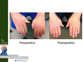 Preoperative Postoperative
 