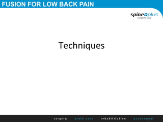 Techniques	
  
FUSION FOR LOW BACK PAIN
 