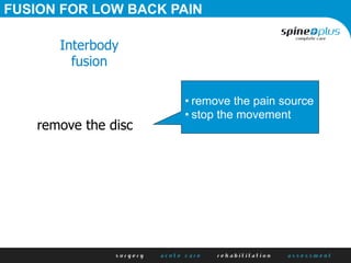 remove the disc
Interbody
fusion
• remove the pain source
• stop the movement
FUSION FOR LOW BACK PAIN
 
