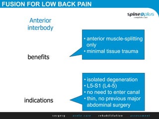 benefits
Anterior
interbody
• anterior muscle-splitting
only
• minimal tissue trauma
indications
• isolated degeneration
• L5-S1 (L4-5)
• no need to enter canal
• thin, no previous major
abdominal surgery
FUSION FOR LOW BACK PAIN
 