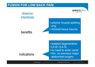 benefits
Anterior
interbody
• anterior muscle-splitting
only
• minimal tissue trauma
indications
• isolated degeneration
• L5-S1 (L4-5)
• no need to enter canal
• thin, no previous major
abdominal surgery
FUSION FOR LOW BACK PAIN
 