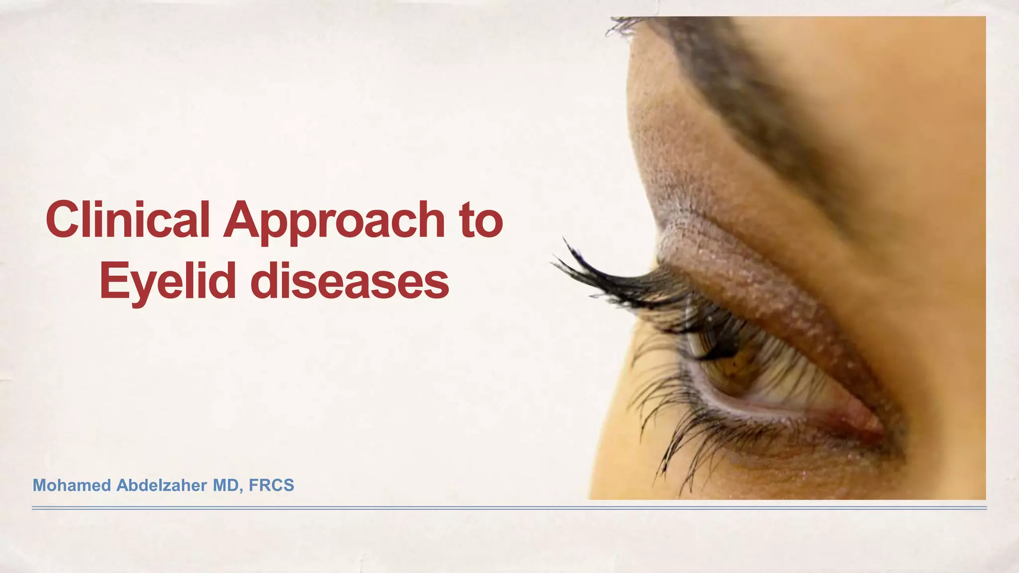 Lid 1 slideshare | PPTX