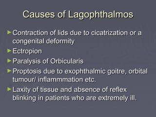 Causes of Lagophthalmos
► Contraction of lids due to cicatrization or a
  congenital deformity
► Ectropion
► Paralysis of Orbicularis
► Proptosis due to exophthalmic goitre, orbital
  tumour/ inflammmation etc.
► Laxity of tissue and absence of reflex
  blinking in patients who are extremely ill.
 
