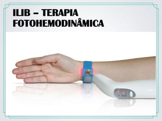 ILIB – TERAPIA
FOTOHEMODINÂMICA
 