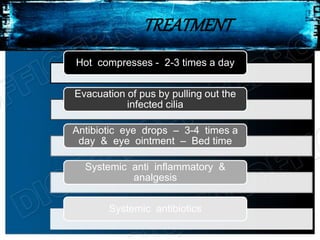 TREATMENT
Hot compresses - 2-3 times a day
Evacuation of pus by pulling out the
infected cilia
Antibiotic eye drops – 3-4 times a
day & eye ointment – Bed time
Systemic anti inflammatory &
analgesis
Systemic antibiotics
 
