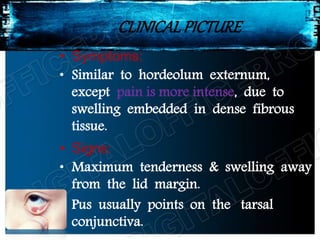 CLINICALPICTURE
• Symptoms:
• Similar to hordeolum externum,
except pain is more intense, due to
swelling embedded in dense fibrous
tissue.
• Signs:
• Maximum tenderness & swelling away
from the lid margin.
• Pus usually points on the tarsal
conjunctiva.
 