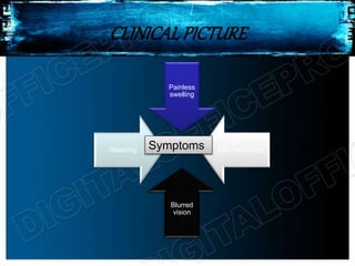 CLINICALPICTURE
Painless
swelling
Mild heaviness
Blurred
vision
Watering Symptoms
 
