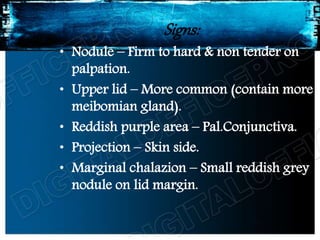 Signs:
• Nodule – Firm to hard & non tender on
palpation.
• Upper lid – More common (contain more
meibomian gland).
• Reddish purple area – Pal.Conjunctiva.
• Projection – Skin side.
• Marginal chalazion – Small reddish grey
nodule on lid margin.
 
