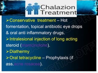 Conservative treatment – Hot
fomentation, topical antibiotic eye drops
& oral anti inflammatory drugs.
Intralesional injection of long acting
steroid (triamcinolone).
Diathermy
Oral tetracycline – Prophylaxis (if
ass.acne rosacea).
 
