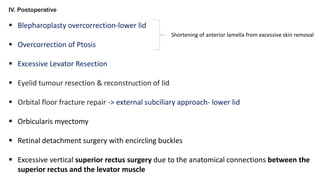 IV. Postoperative
 Blepharoplasty overcorrection-lower lid
 Overcorrection of Ptosis
 Excessive Levator Resection
 Eyelid tumour resection & reconstruction of lid
 Orbital floor fracture repair -> external subciliary approach- lower lid
 Orbicularis myectomy
 Retinal detachment surgery with encircling buckles
 Excessive vertical superior rectus surgery due to the anatomical connections between the
superior rectus and the levator muscle
Shortening of anterior lamella from excessive skin removal
 