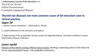 I. Inflammatory causes of lid retractions are:
Thyroid eye disease
Orbital Pseudotumour
Cicatricial conjunctival Disease
Thyroid eye diseases are most common cause of lid retraction seen in
clinical practice.
Upper lid
1. Levator muscle contraction – inflammation, fibrosis
2. Levator adhesions to the orbicularis and septum
3. Hyperactivity of the sympathetic nervous system (in hyperthyroidism)- activation of Muller's muscle,
inflammatory fibrosis of Muller’s
Lower eyelid
Fibrosis of the inferior rectus/ inferior tarsal muscle, exerting a retracting action to the lower lid
via its capsulopalpebral head, is the probable mechanism.
 