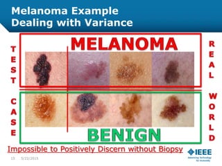 Melanoma Example
Dealing with Variance
Impossible to Positively Discern without Biopsy
15 5/23/2015
 